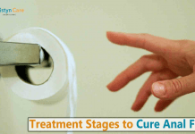 What do you need to know about Fissure Laser Treatment? Fissure Laser Treatment