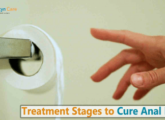 What do you need to know about Fissure Laser Treatment? Fissure Laser Treatment