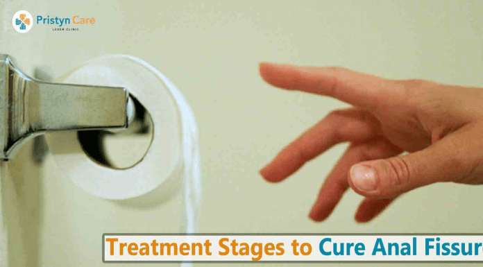 What do you need to know about Fissure Laser Treatment? Fissure Laser Treatment