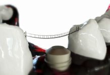 What am I responsible for in the orthodontic treatment?