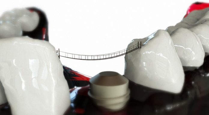 What am I responsible for in the orthodontic treatment?