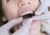 The Key Differences Between an Orthodontist and Dentist That You Should Know