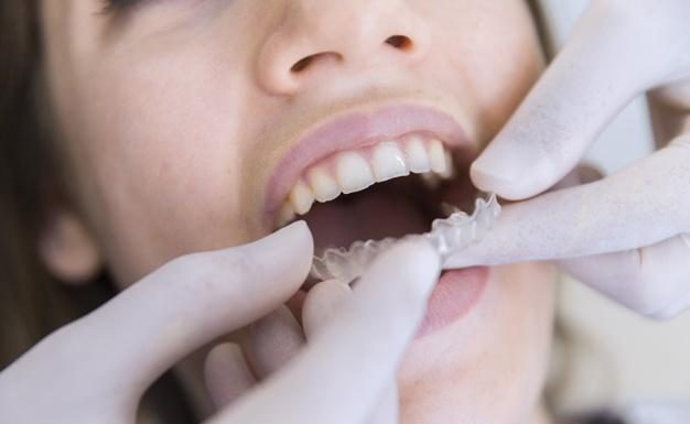 The Key Differences Between an Orthodontist and Dentist That You Should Know
